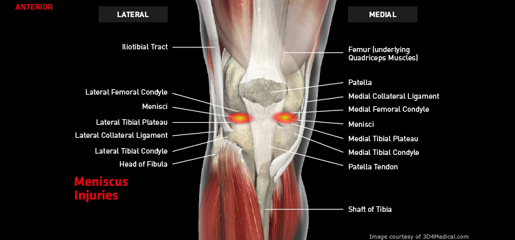 knee-meniscusinjuries-large-thermoskin-supports-and-braces-for